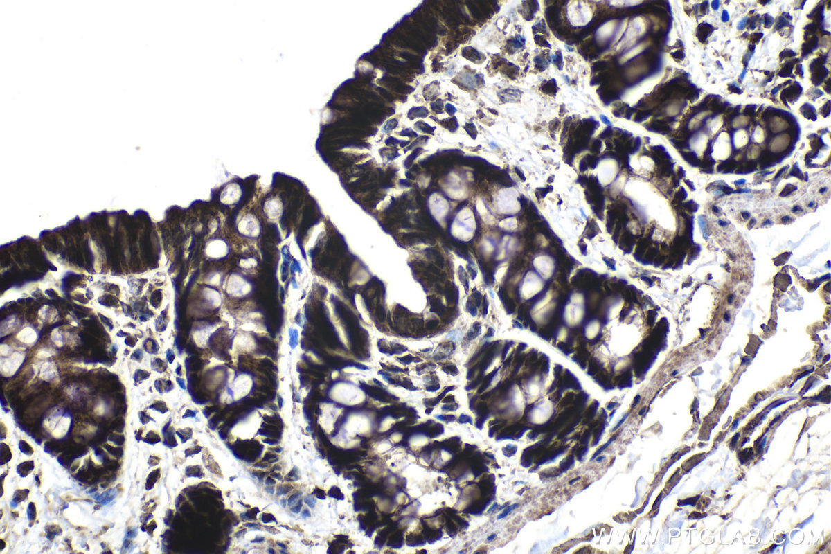 Immunohistochemical analysis of paraffin-embedded rat colon tissue slide using KHC1379 (GLI2 IHC Kit).