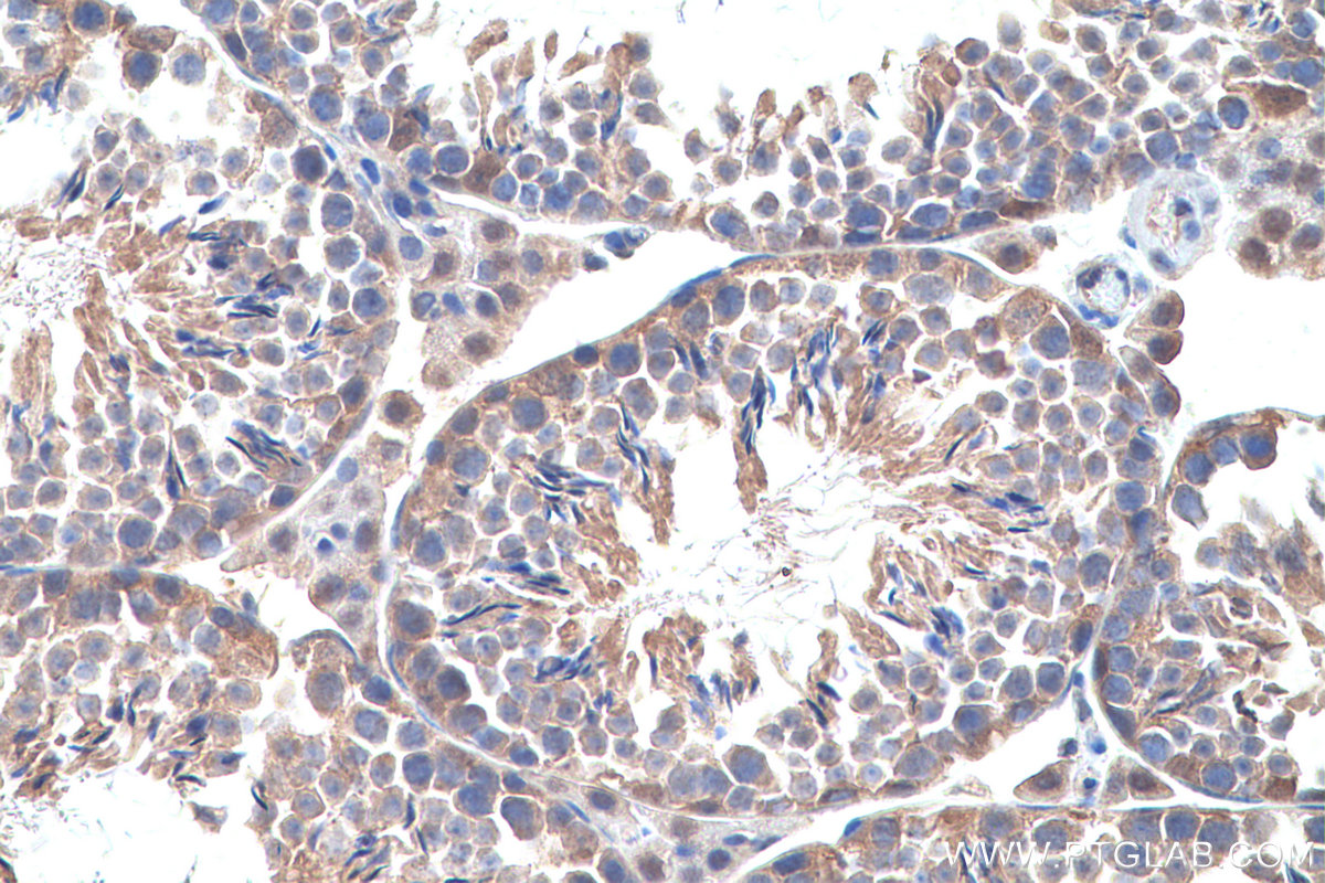 Immunohistochemical analysis of paraffin-embedded mouse testis tissue slide using KHC0694 (GLO1 IHC Kit).