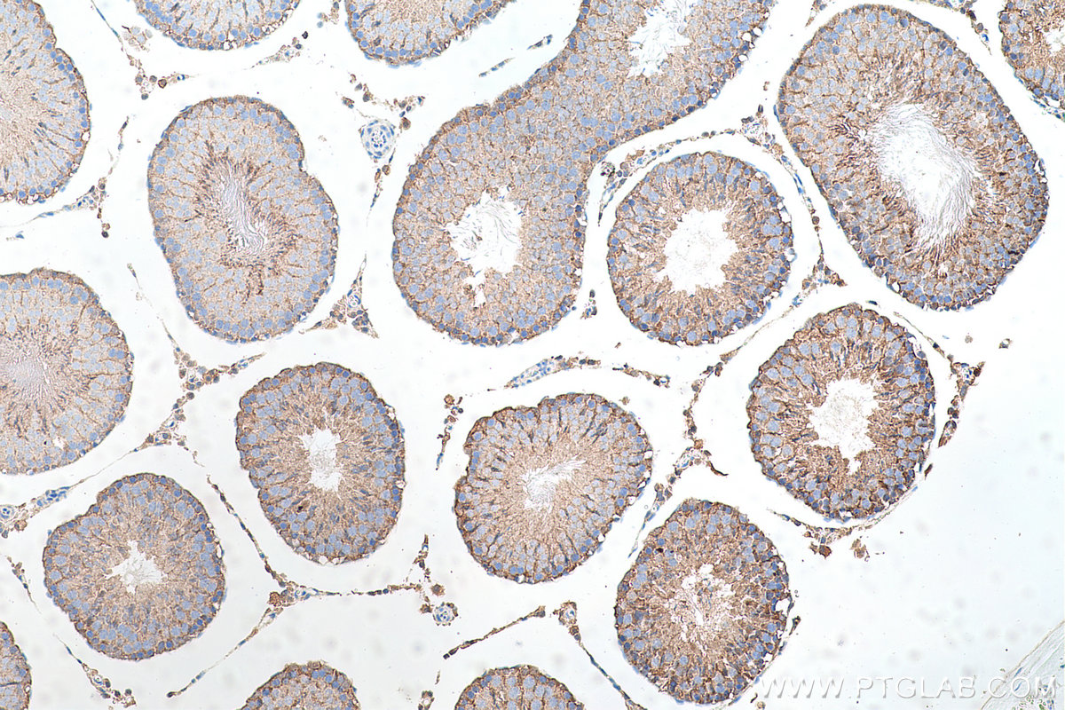 Immunohistochemical analysis of paraffin-embedded rat testis tissue slide using KHC0694 (GLO1 IHC Kit).