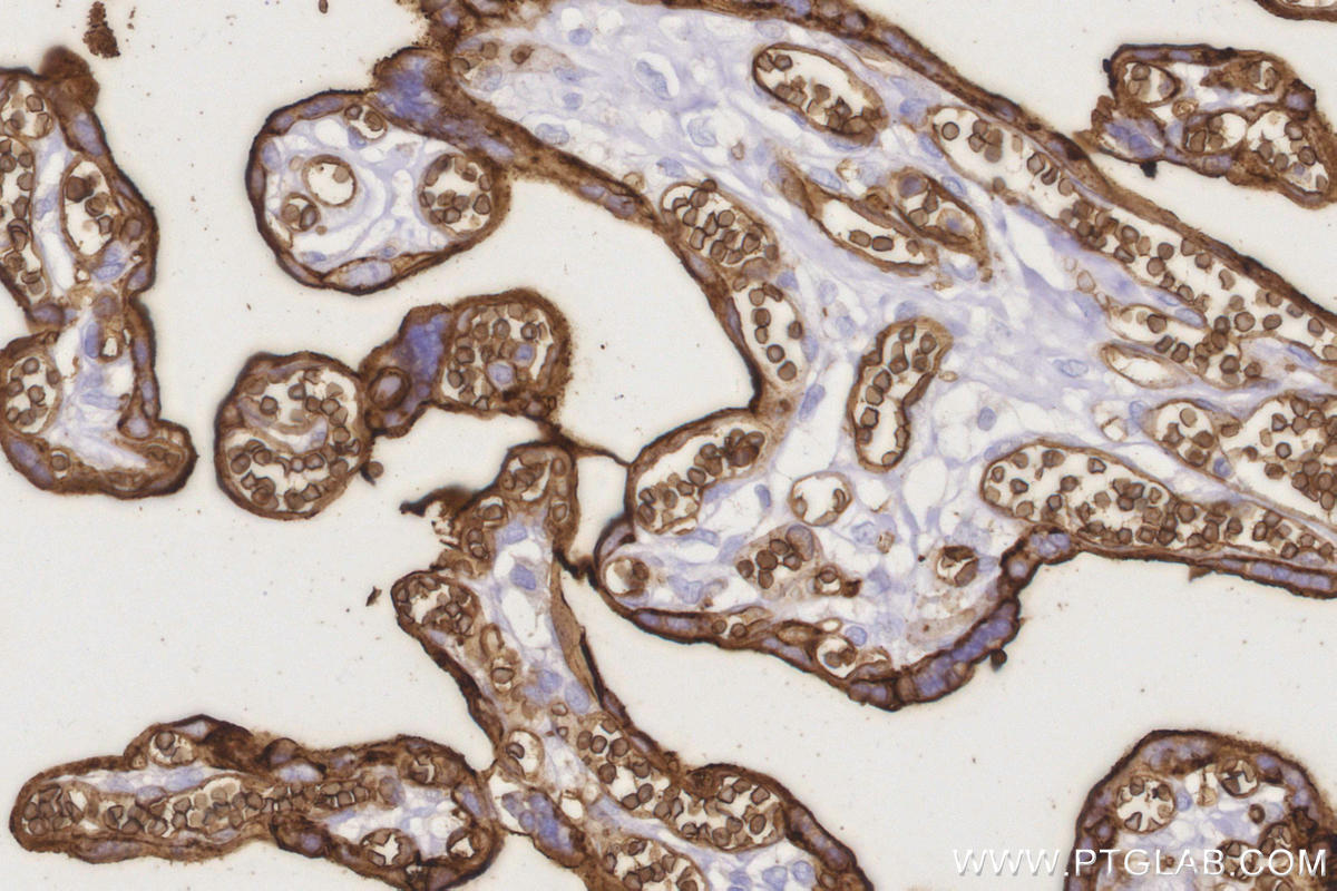 Immunohistochemical analysis of paraffin-embedded human placenta tissue slide using KHC0036 (GLUT1 IHC Kit). Immunohistochemical analysis of paraffin-embedded human placenta tissue slide using KHC0036 (GLUT1 IHC Kit).