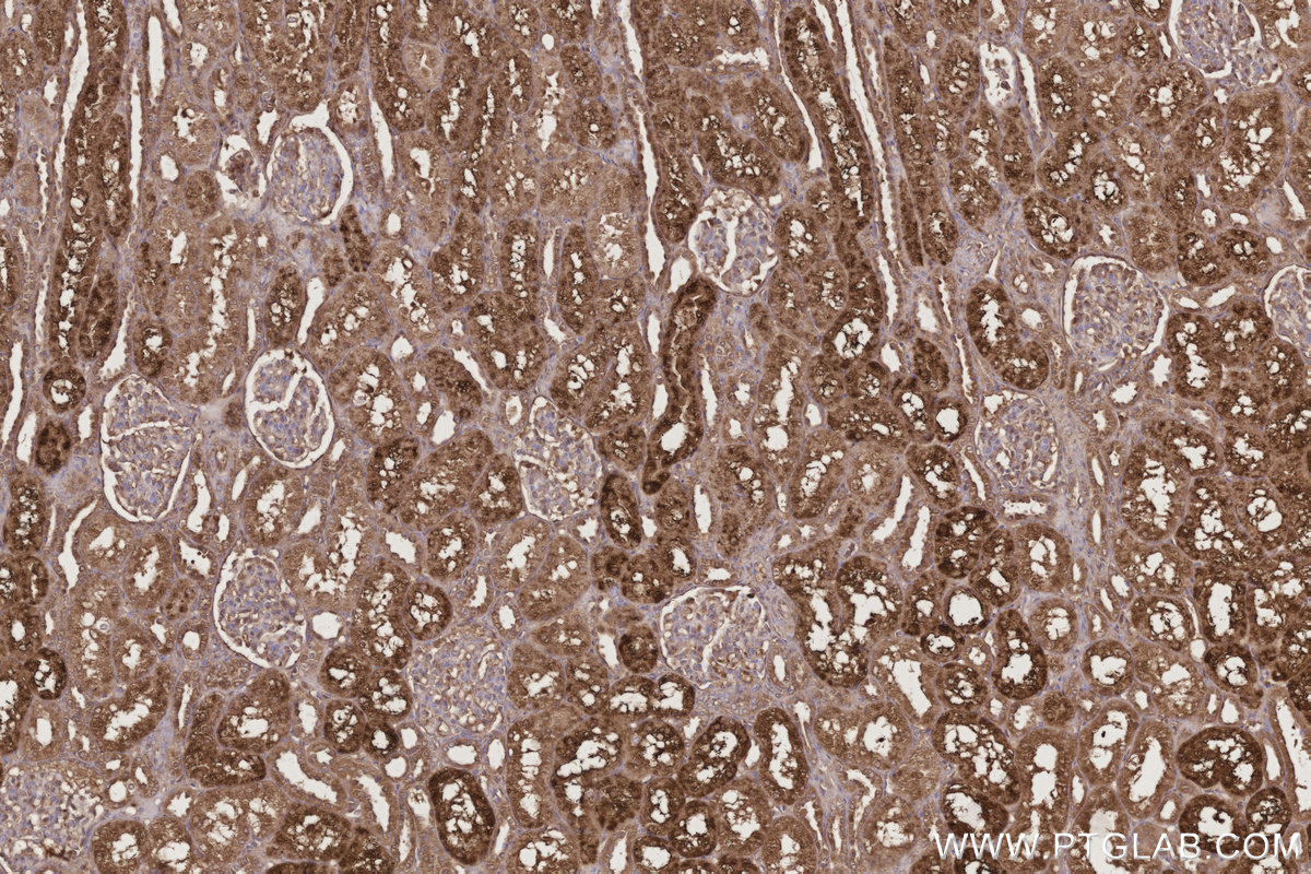 Immunohistochemical analysis of paraffin-embedded human kidney tissue slide using KHC3194 (GM2A IHC Kit).