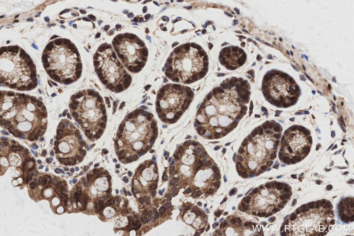 Immunohistochemical analysis of paraffin-embedded mouse colon tissue slide using KHC2988 (GMIP IHC Kit). Immunohistochemical analysis of paraffin-embedded mouse colon tissue slide using KHC2988 (GMIP IHC Kit).