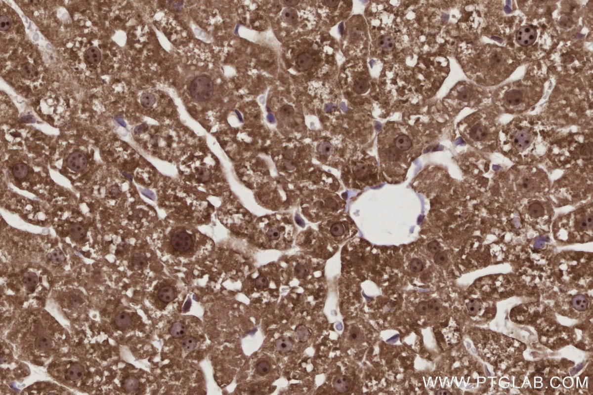 Immunohistochemical analysis of paraffin-embedded mouse liver tissue slide using KHC2988 (GMIP IHC Kit). Immunohistochemical analysis of paraffin-embedded mouse liver tissue slide using KHC2988 (GMIP IHC Kit).