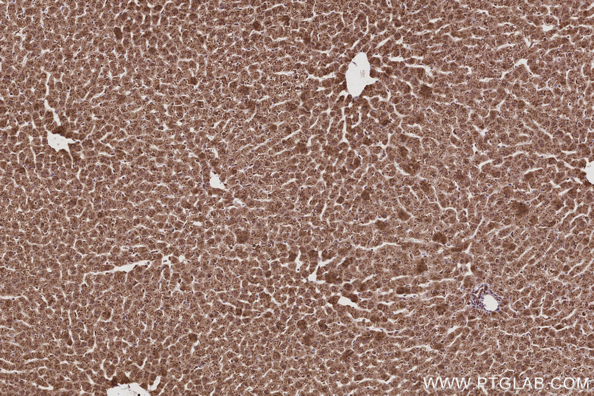 Immunohistochemical analysis of paraffin-embedded rat liver tissue slide using KHC2988 (GMIP IHC Kit). Immunohistochemical analysis of paraffin-embedded rat liver tissue slide using KHC2988 (GMIP IHC Kit).
