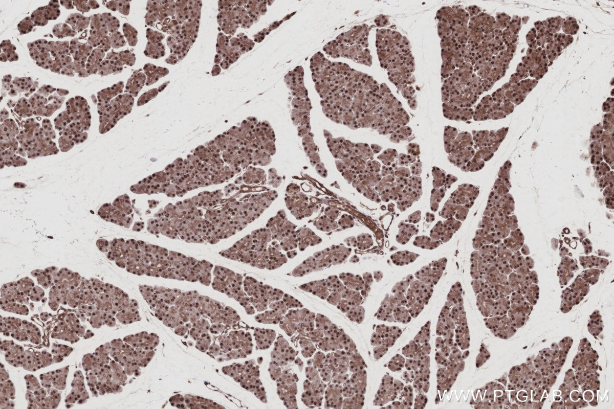Immunohistochemical analysis of paraffin-embedded rat pancreas tissue slide using KHC2988 (GMIP IHC Kit). Immunohistochemical analysis of paraffin-embedded rat pancreas tissue slide using KHC2988 (GMIP IHC Kit).