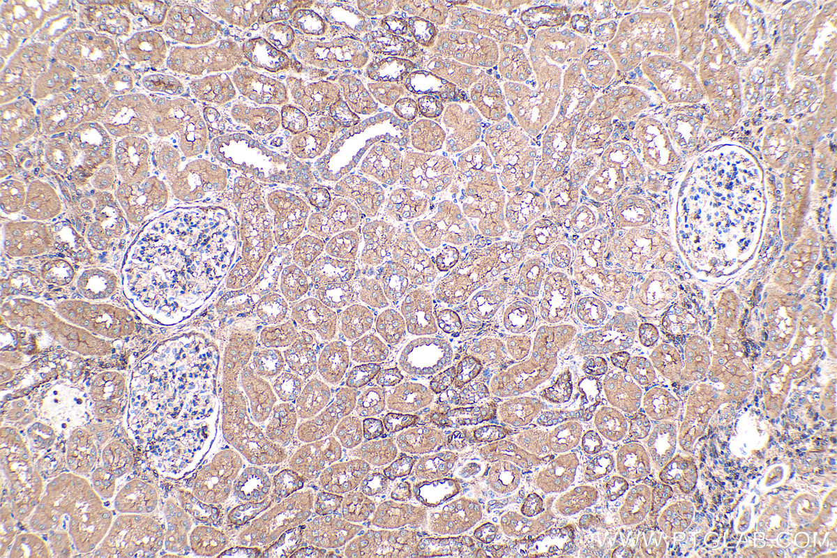 Immunohistochemical analysis of paraffin-embedded human kidney tissue slide using KHC0423 (GNAI1 IHC Kit).