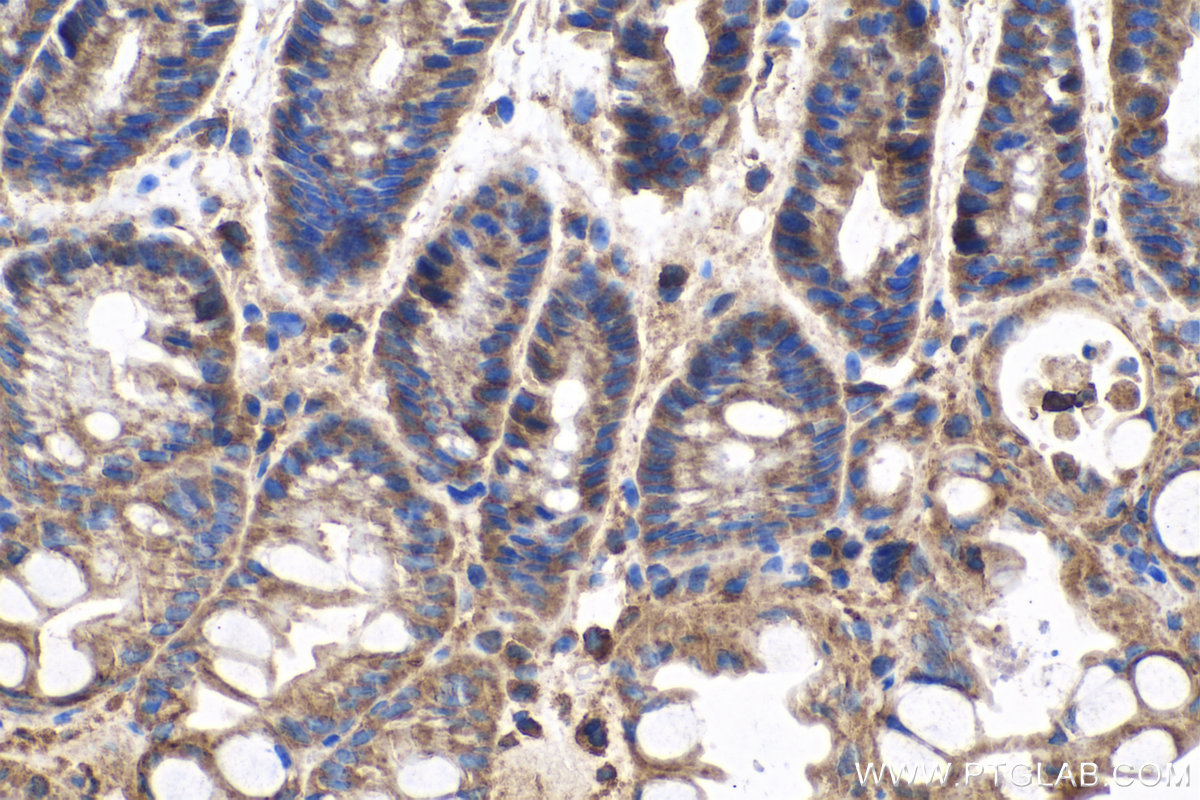 Immunohistochemical analysis of paraffin-embedded mouse colon tissue slide using KHC0423 (GNAI1 IHC Kit).