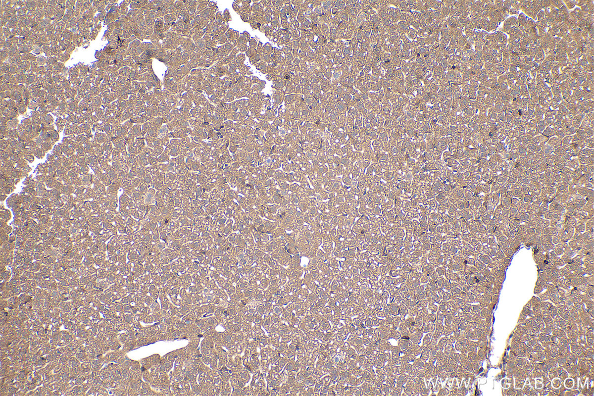 Immunohistochemical analysis of paraffin-embedded mouse liver tissue slide using KHC0423 (GNAI1 IHC Kit).