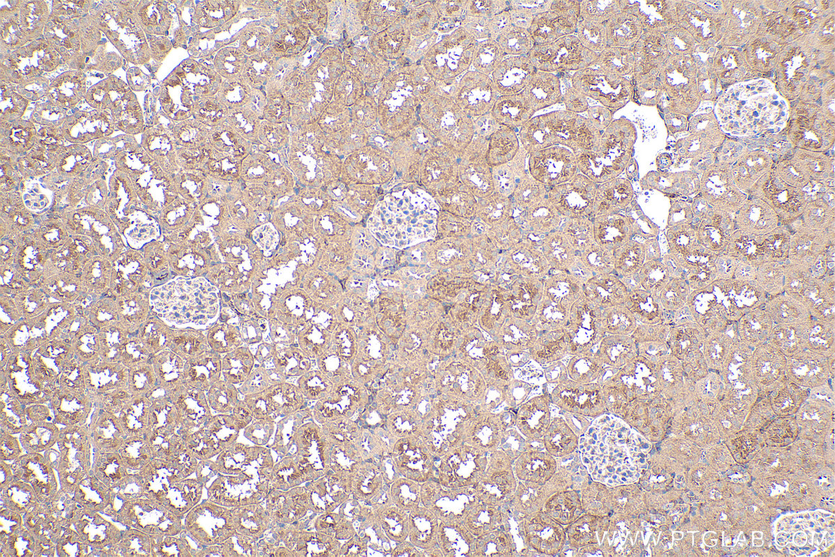 Immunohistochemical analysis of paraffin-embedded rat kidney tissue slide using KHC0423 (GNAI1 IHC Kit).