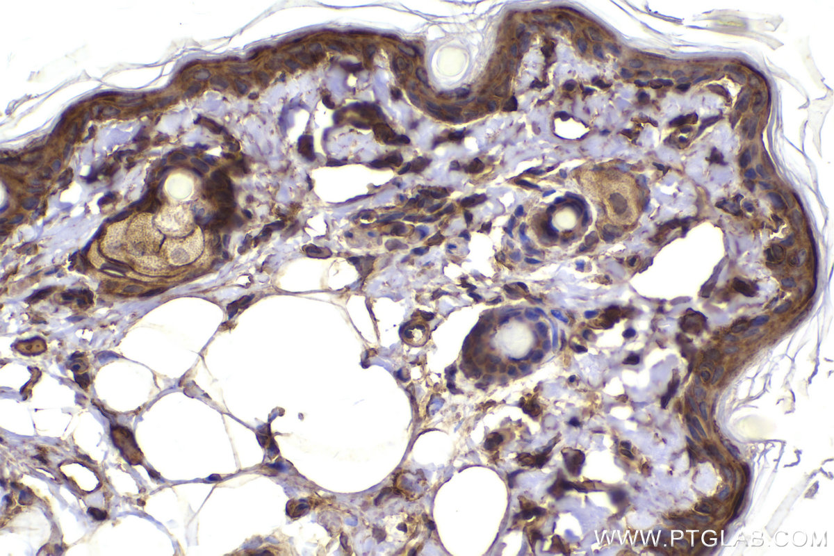 Immunohistochemical analysis of paraffin-embedded rat skin tissue slide using KHC2171 (GNAI3 IHC Kit).