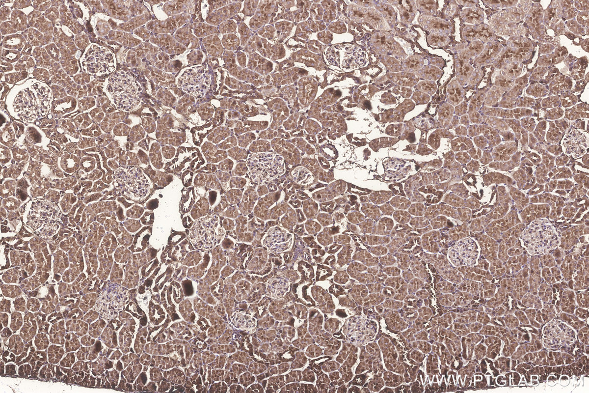 Immunohistochemical analysis of paraffin-embedded rat kidney tissue slide using KHC3244 (GNB1 IHC Kit).