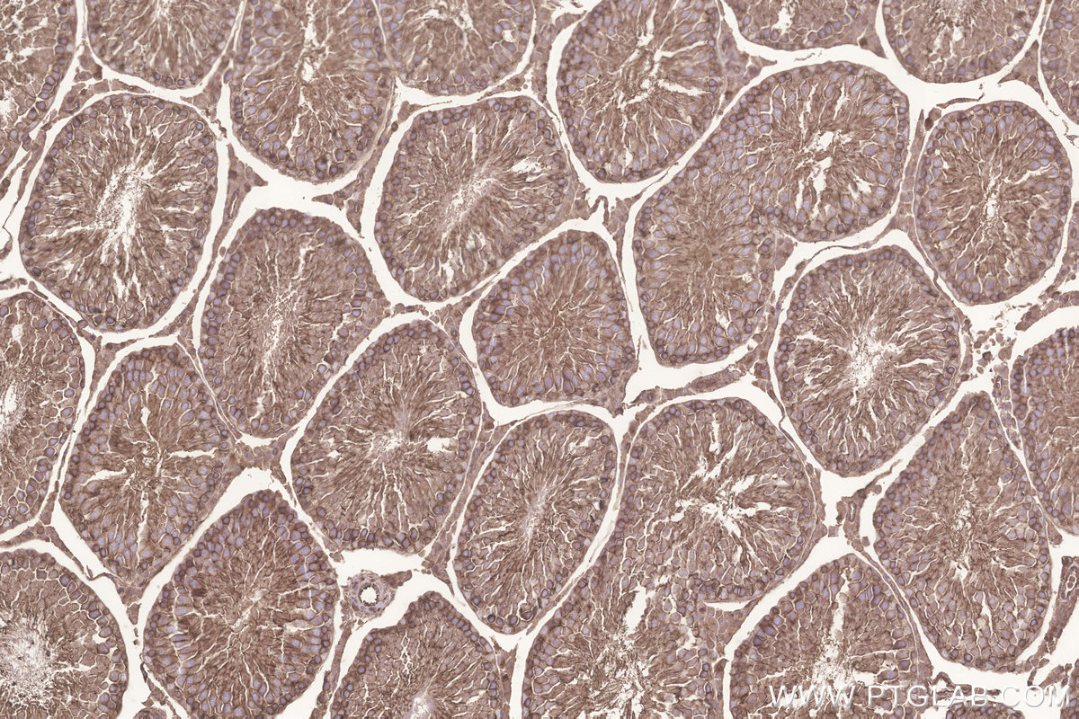 Immunohistochemical analysis of paraffin-embedded rat testis tissue slide using KHC3244 (GNB1 IHC Kit).