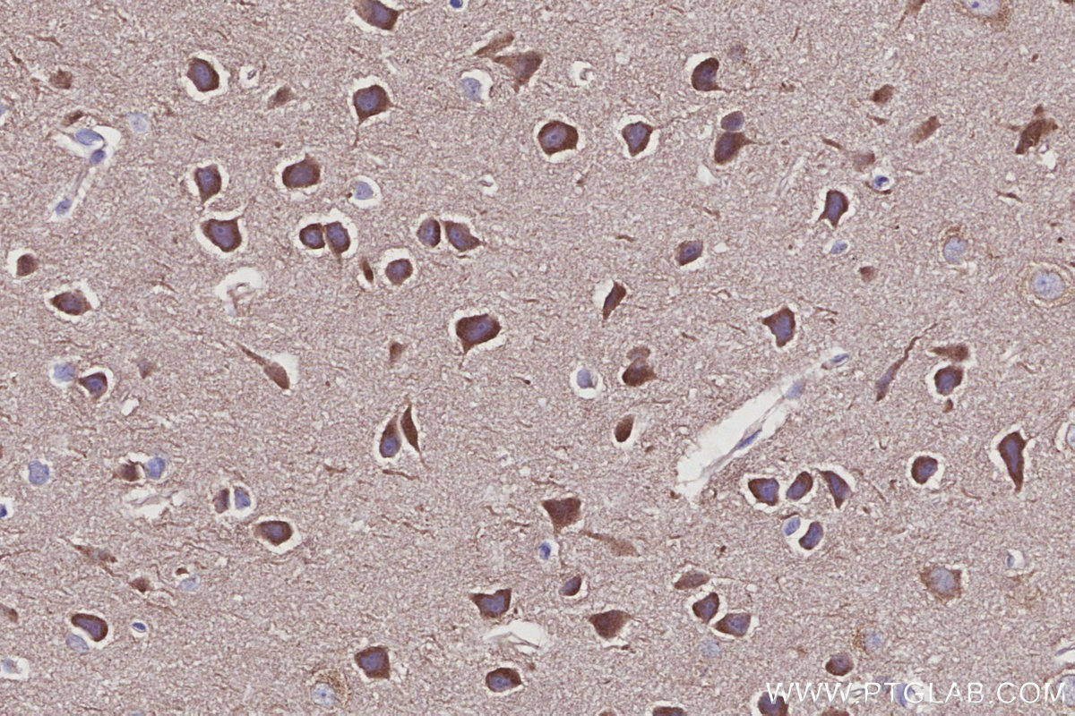 Immunohistochemical analysis of paraffin-embedded mouse brain tissue slide using KHC2933 (GOPC IHC Kit).