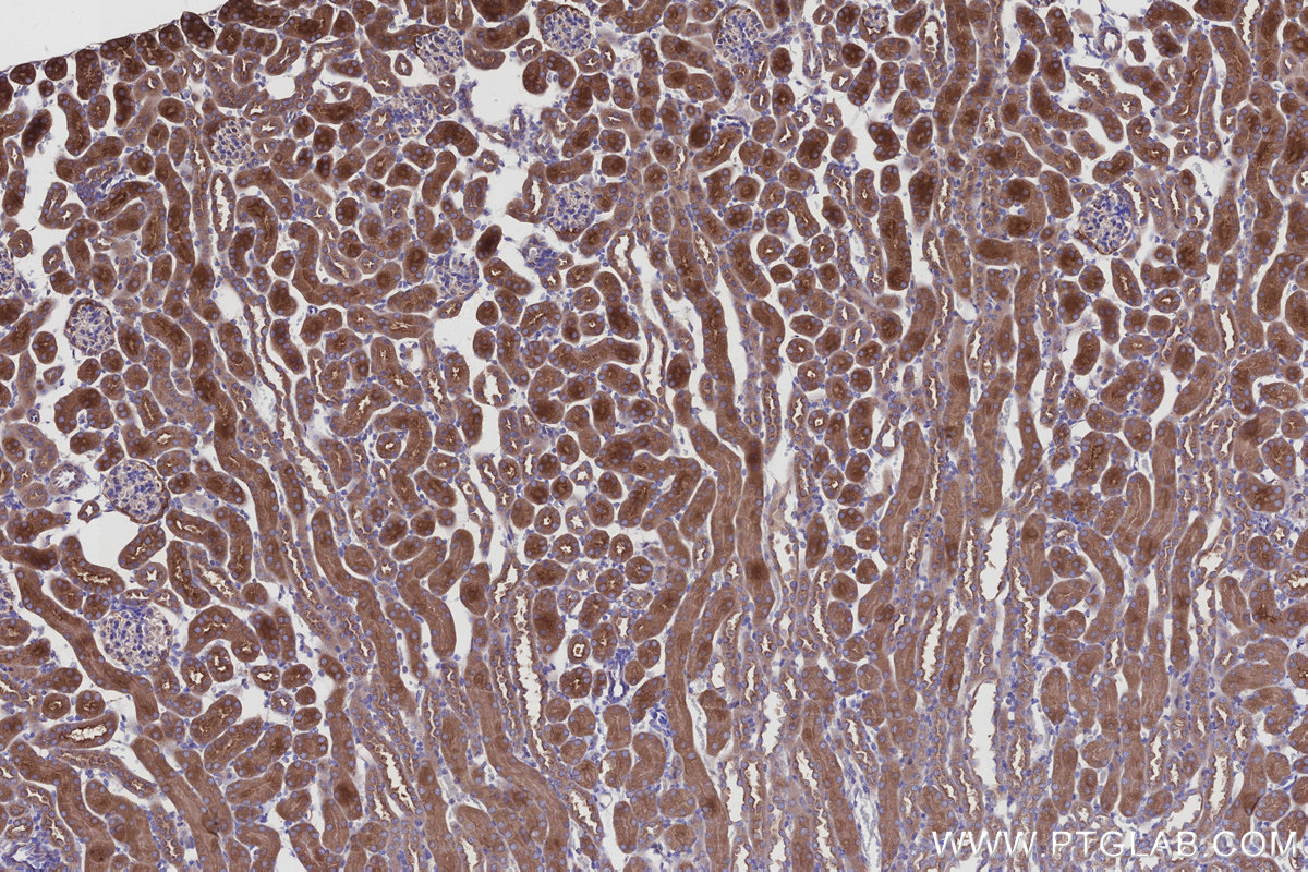 Immunohistochemical analysis of paraffin-embedded mouse kidney tissue slide using KHC2933 (GOPC IHC Kit).