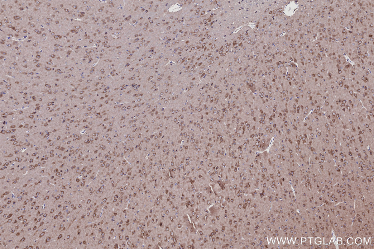Immunohistochemical analysis of paraffin-embedded rat brain tissue slide using KHC2933 (GOPC IHC Kit).