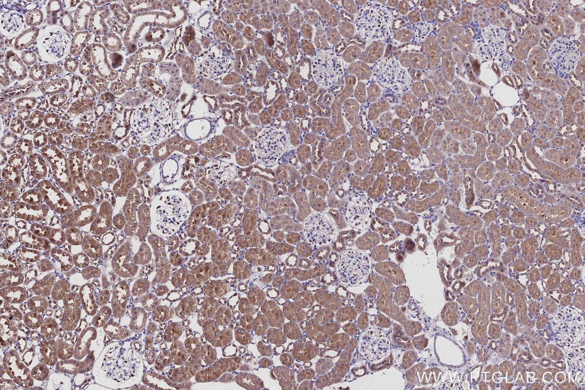 Immunohistochemical analysis of paraffin-embedded rat kidney tissue slide using KHC2933 (GOPC IHC Kit).