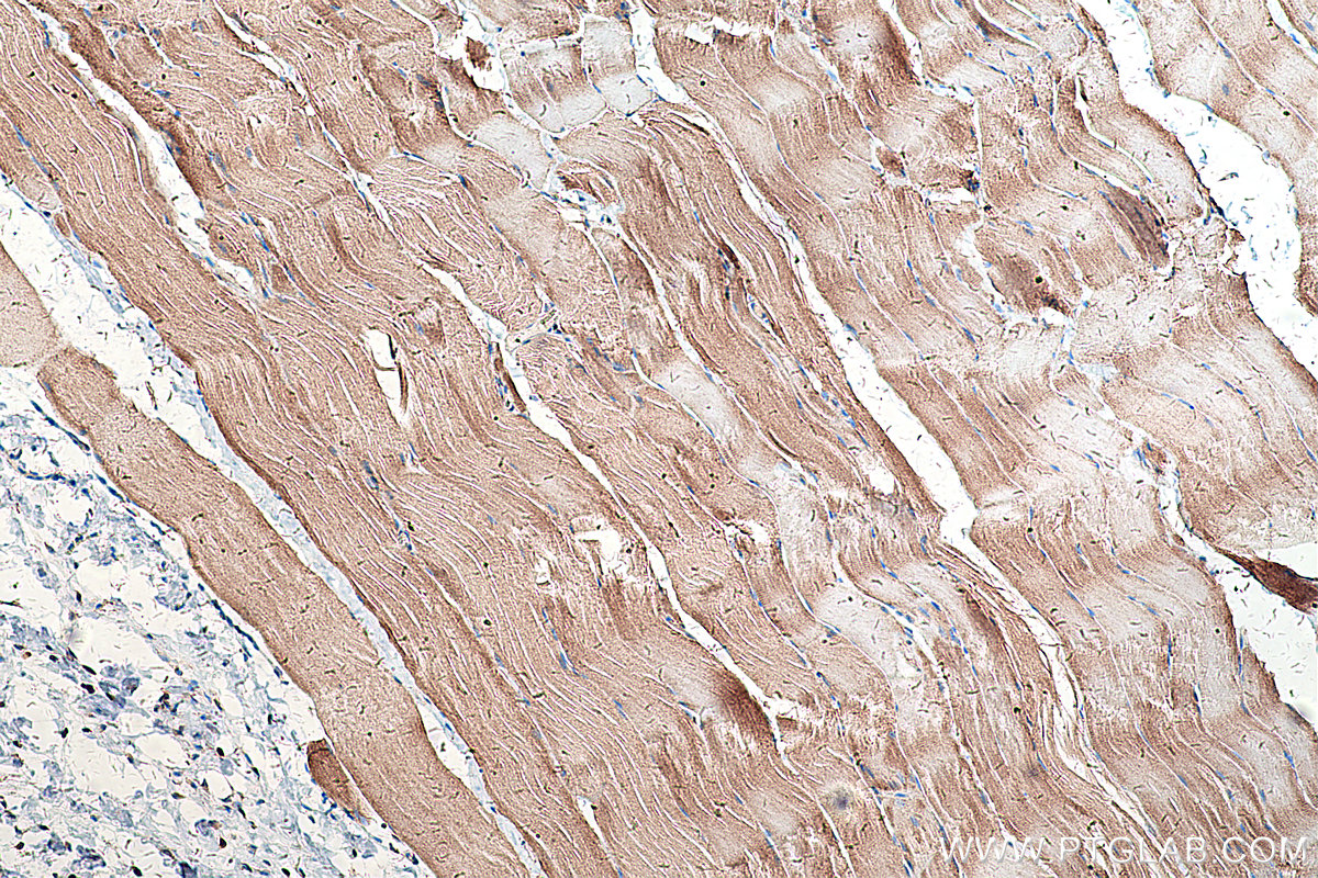 Immunohistochemical analysis of paraffin-embedded rat skeletal muscle tissue slide using KHC0320 (GOT2 IHC Kit).