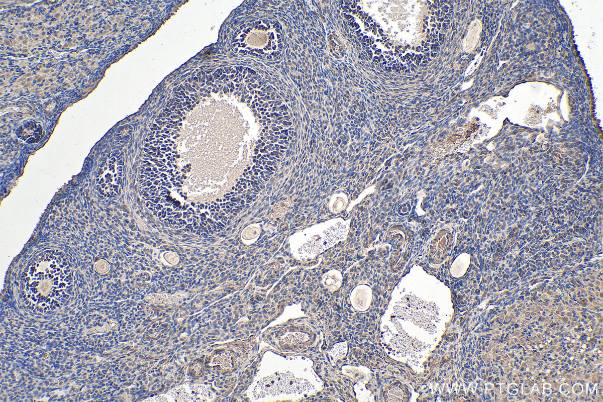 Immunohistochemical analysis of paraffin-embedded rat ovary tissue slide using KHC0235 (GPD1 IHC Kit).