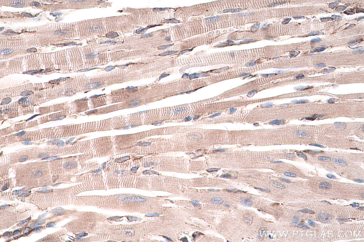 Immunohistochemical analysis of paraffin-embedded mouse heart tissue slide using KHC0236 (GPD2 IHC Kit).