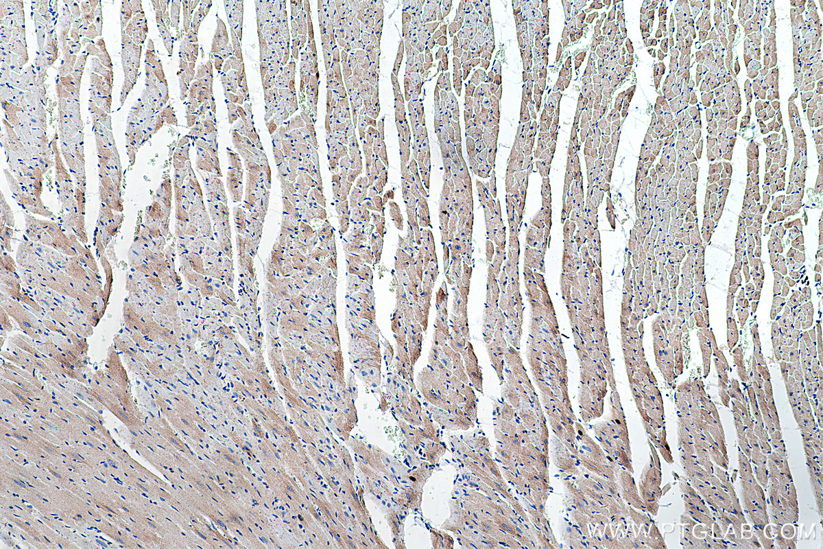 Immunohistochemical analysis of paraffin-embedded rat heart tissue slide using KHC0236 (GPD2 IHC Kit).