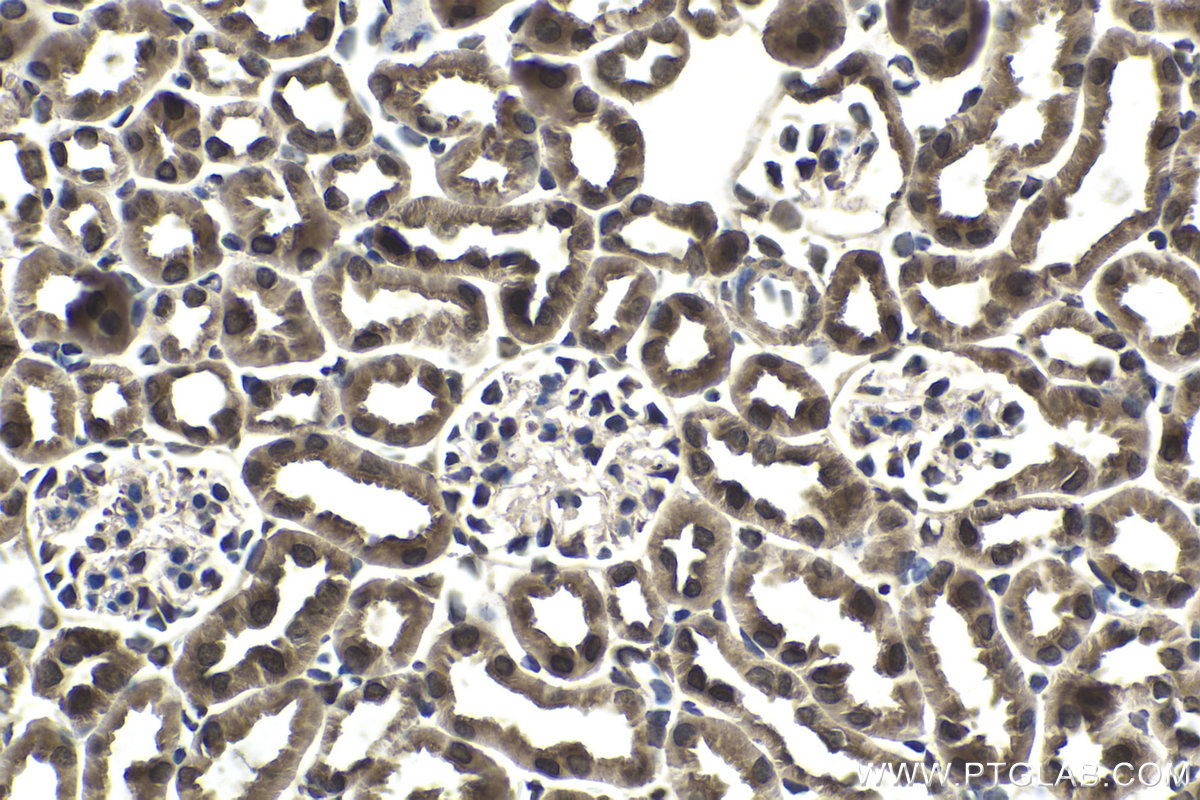 Immunohistochemical analysis of paraffin-embedded mouse kidney tissue slide using KHC1706 (GPS2 IHC Kit).