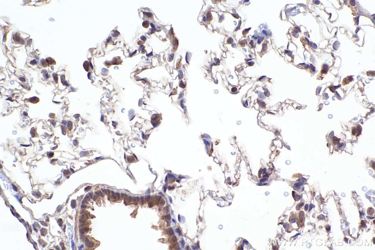 Immunohistochemical analysis of paraffin-embedded rat lung tissue slide using KHC2370 (GPSM2 IHC Kit).