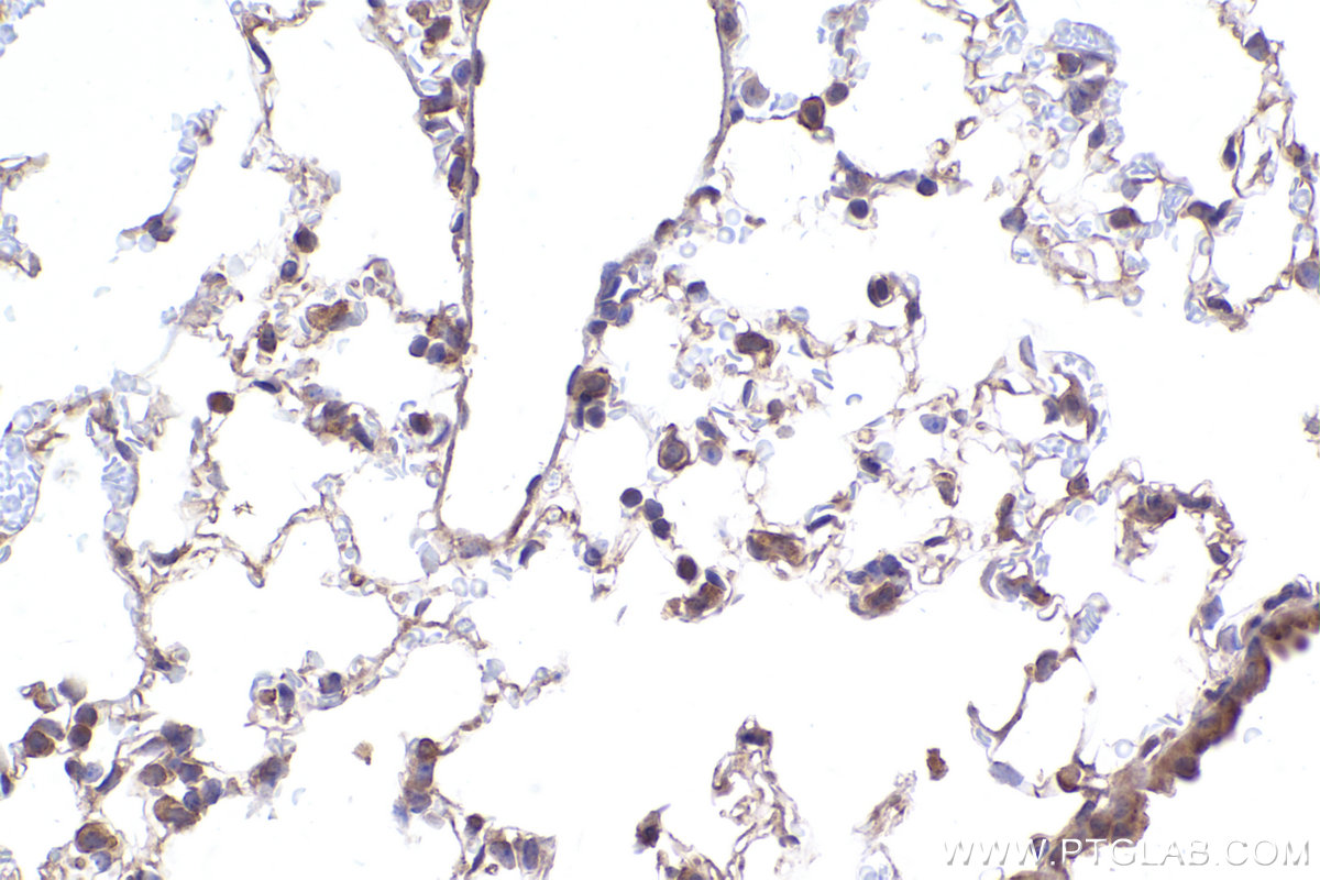 Immunohistochemical analysis of paraffin-embedded mouse lung tissue slide using KHC2370 (GPSM2 IHC Kit).