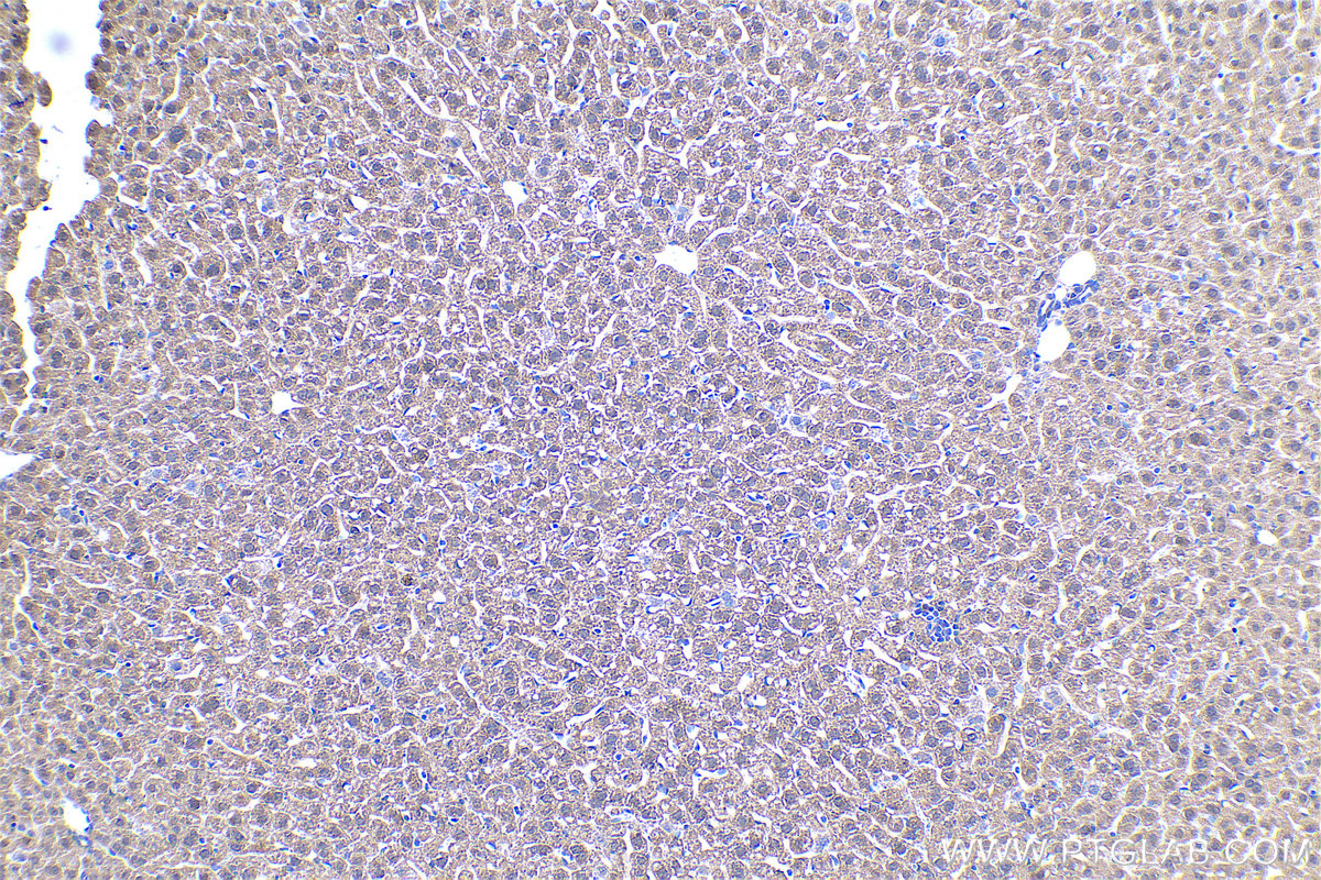 Immunohistochemical analysis of paraffin-embedded mouse liver tissue slide using KHC0520 (GRHPR IHC Kit).