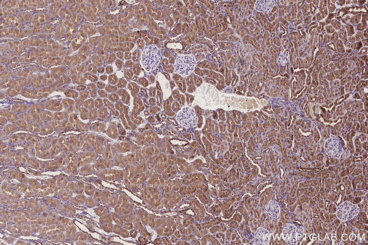 Immunohistochemical analysis of paraffin-embedded rat kidney tissue slide using KHC3279 (GRINA IHC Kit).