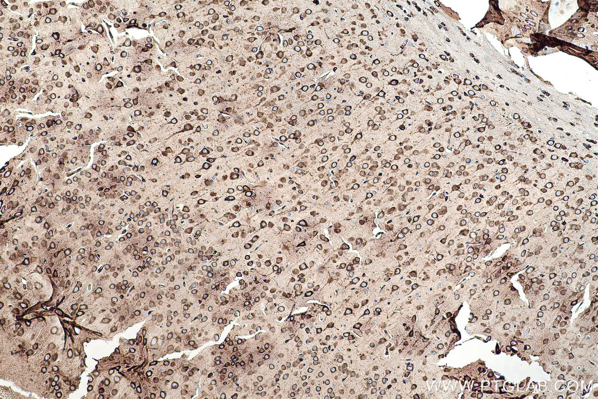 Immunohistochemical analysis of paraffin-embedded mouse brain tissue slide using KHC0509 (GRP78/HSPA5 IHC Kit).