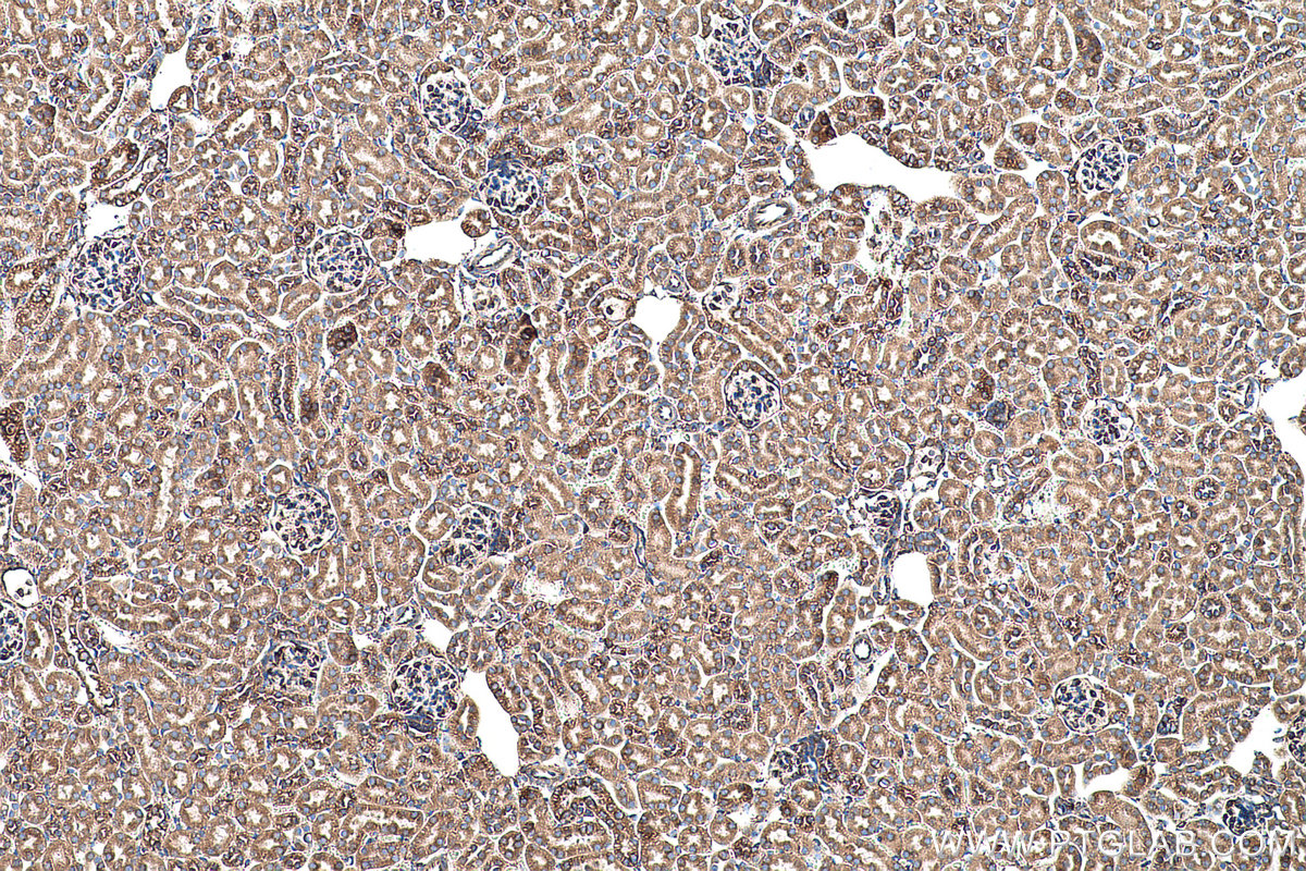Immunohistochemical analysis of paraffin-embedded mouse kidney tissue slide using KHC0509 (GRP78/HSPA5 IHC Kit).