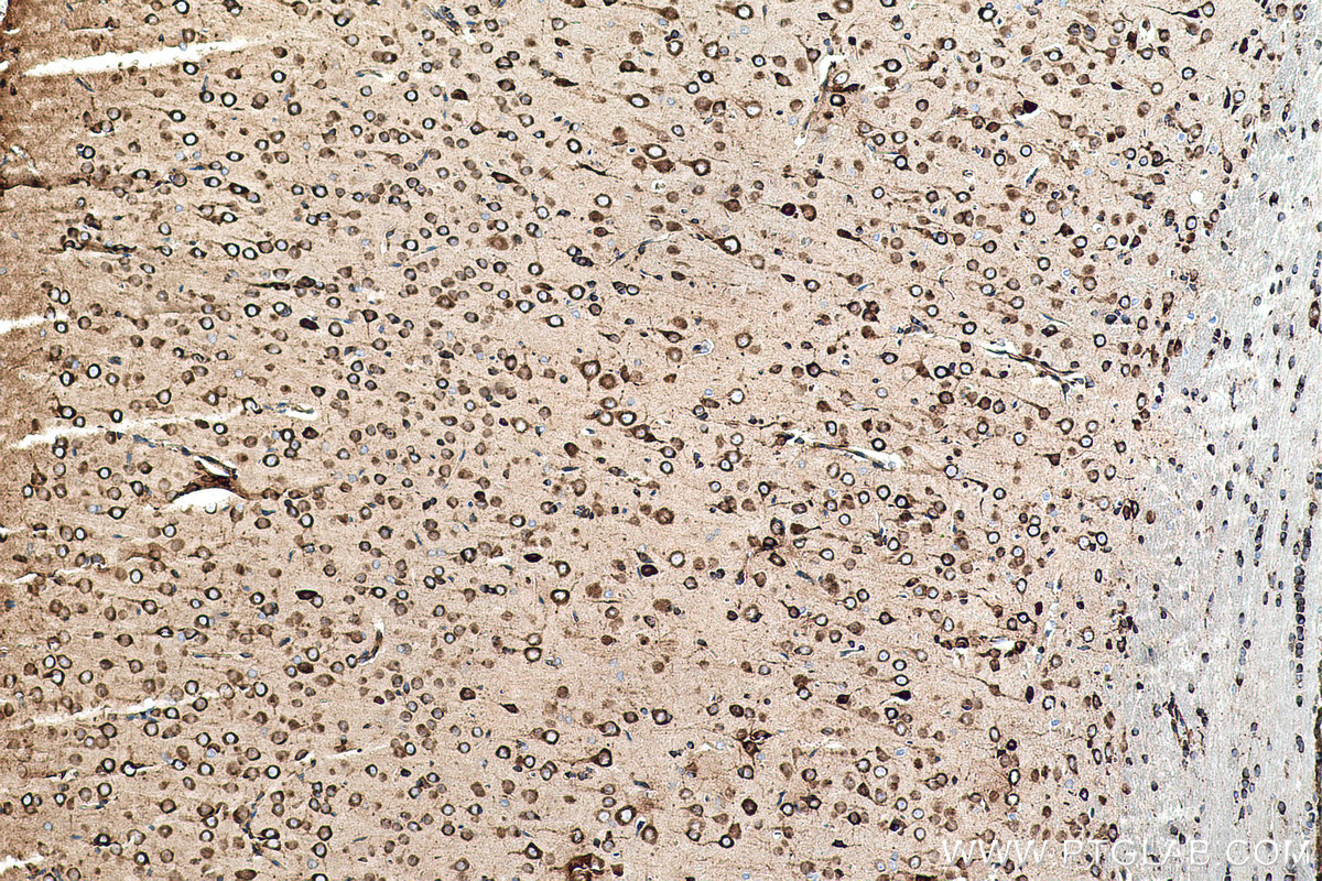 Immunohistochemical analysis of paraffin-embedded rat brain tissue slide using KHC0509 (GRP78/HSPA5 IHC Kit).