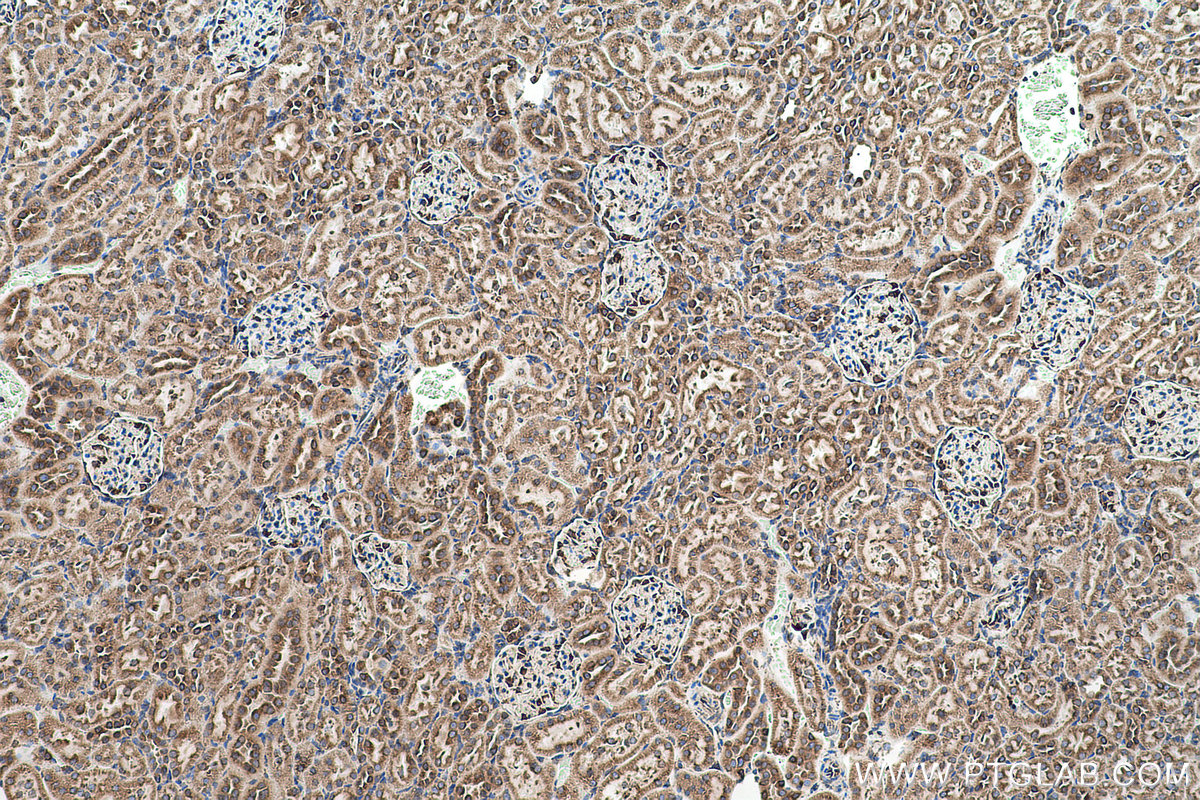 Immunohistochemical analysis of paraffin-embedded rat kidney tissue slide using KHC0509 (GRP78/HSPA5 IHC Kit).