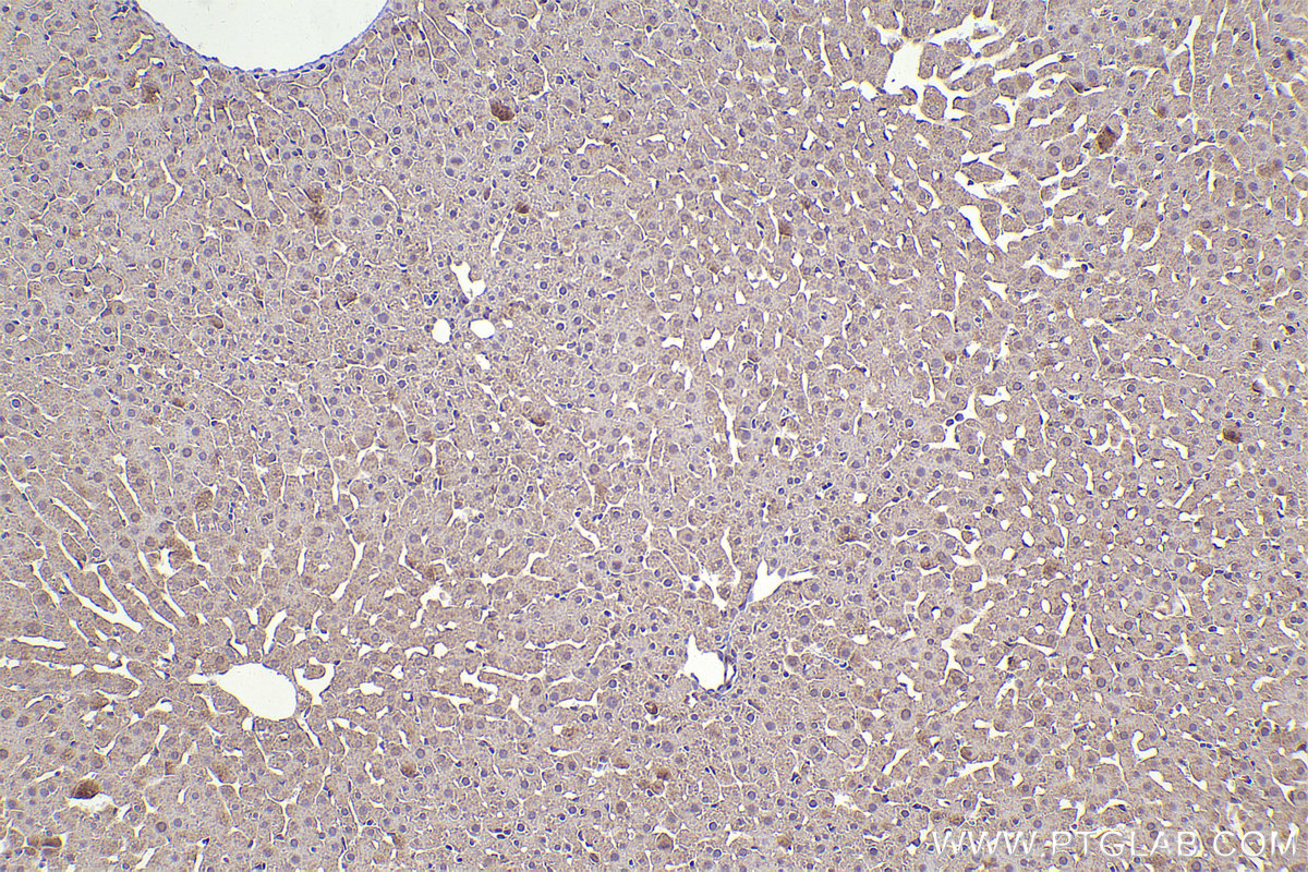 Immunohistochemical analysis of paraffin-embedded rat liver tissue slide using KHC2332 (GSDMD  IHC Kit).