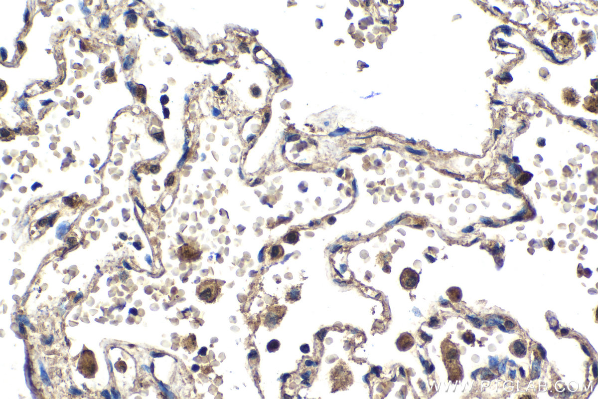 Immunohistochemical analysis of paraffin-embedded human lung tissue slide using KHC2097 (GSDME/DFNA5 IHC Kit).