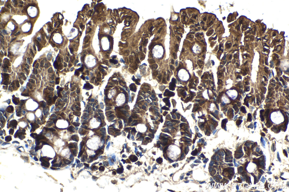 Immunohistochemical analysis of paraffin-embedded mouse intestine tissue slide using KHC2097 (GSDME/DFNA5 IHC Kit).