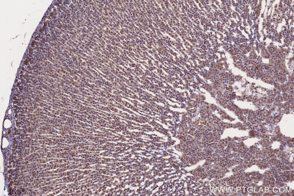 Immunohistochemical analysis of paraffin-embedded rat adrenal gland tissue slide using KHC2660 (GSPT2 IHC Kit).