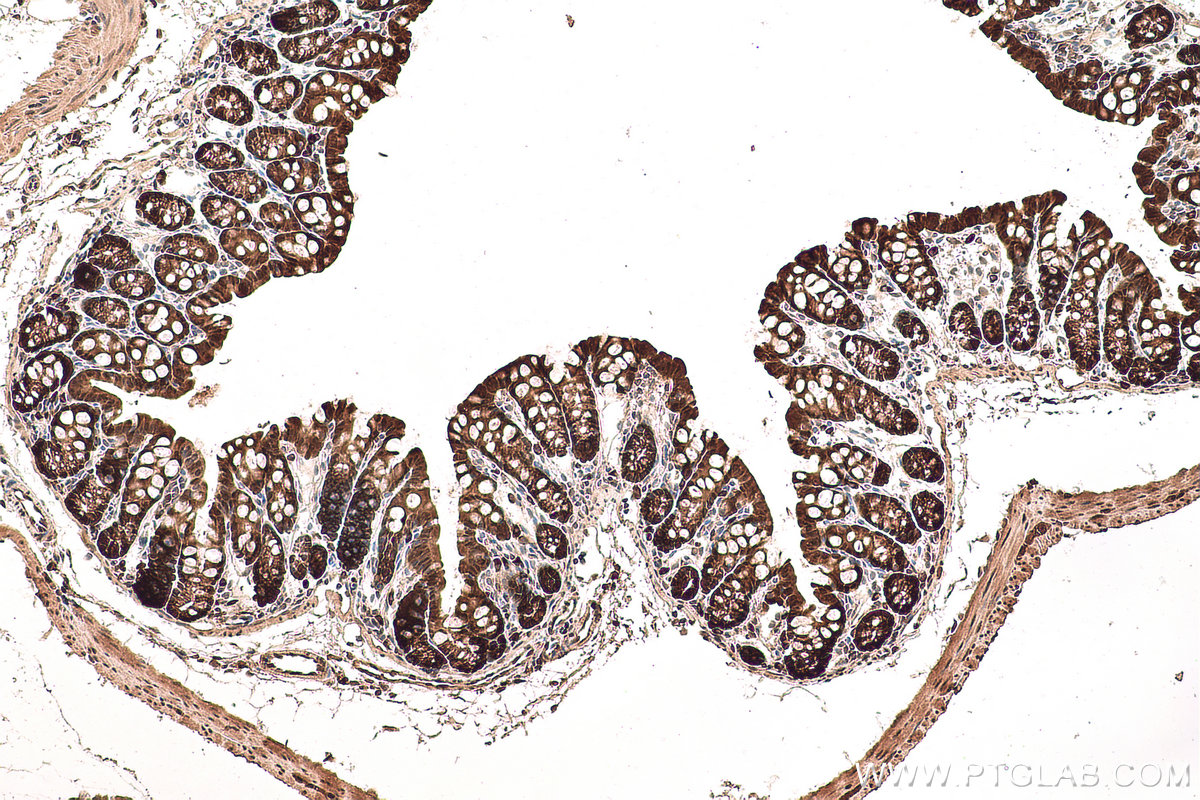 Immunohistochemical analysis of paraffin-embedded mouse colon tissue slide using KHC0781 (GSS IHC Kit).