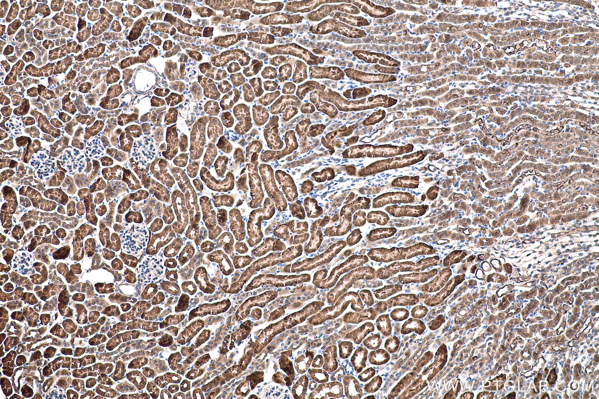 Immunohistochemical analysis of paraffin-embedded mouse kidney tissue slide using KHC0787 (GSTCD IHC Kit).