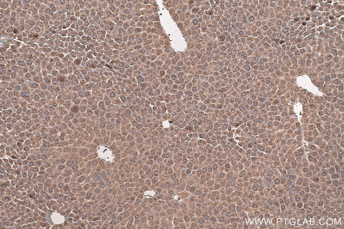 Immunohistochemical analysis of paraffin-embedded mouse liver tissue slide using KHC0791 (GSTO2 IHC Kit).