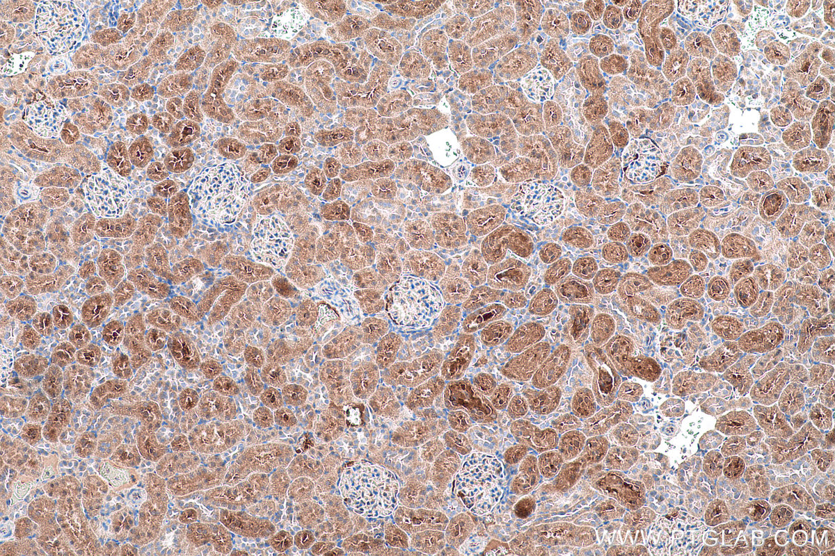 Immunohistochemical analysis of paraffin-embedded rat kidney tissue slide using KHC0548 (GSTP1 IHC Kit).