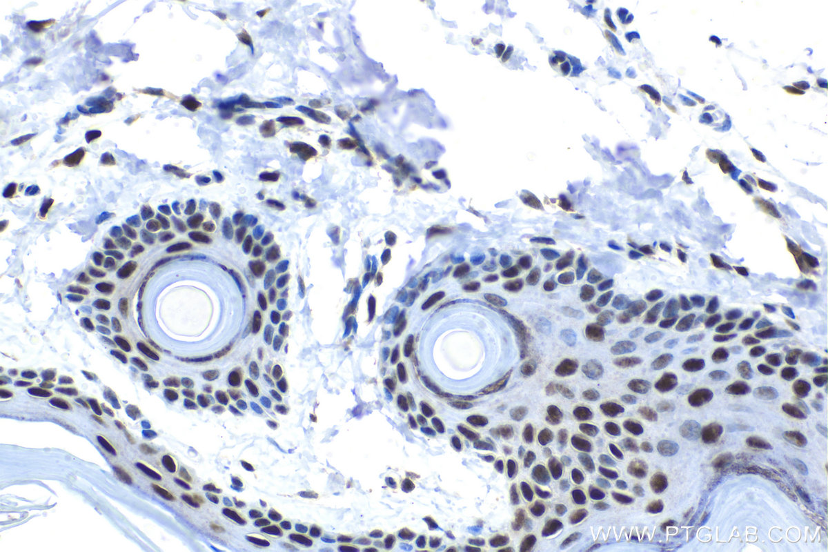 Immunohistochemical analysis of paraffin-embedded rat skin tissue slide using KHC1530 (GTF2F2 IHC Kit).