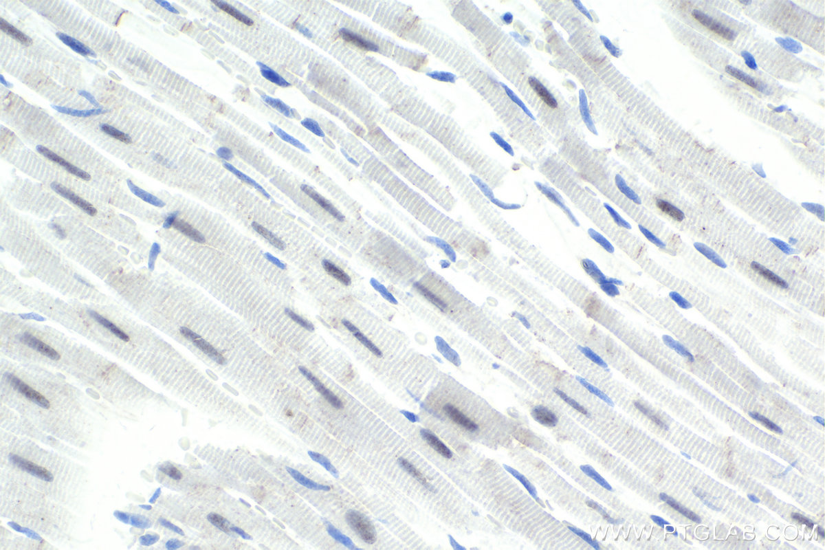 Immunohistochemical analysis of paraffin-embedded rat heart tissue slide using KHC1843 (GTF3C2 IHC Kit).