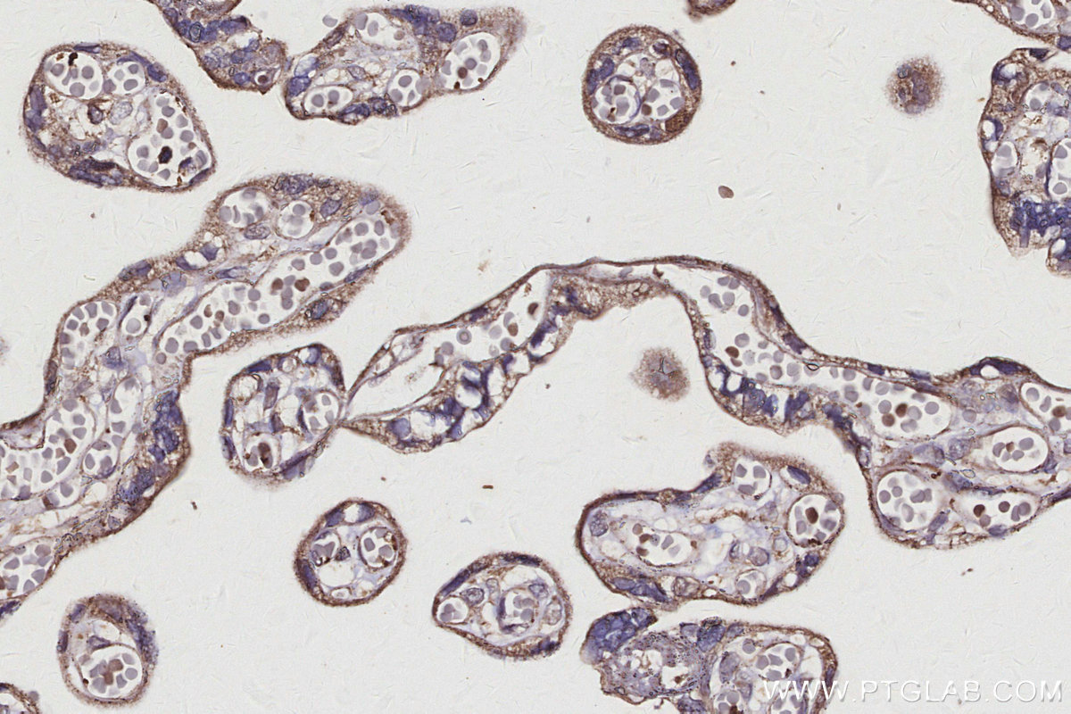 Immunohistochemical analysis of paraffin-embedded human placenta tissue slide using KHC2976 (GTSE1 IHC Kit).