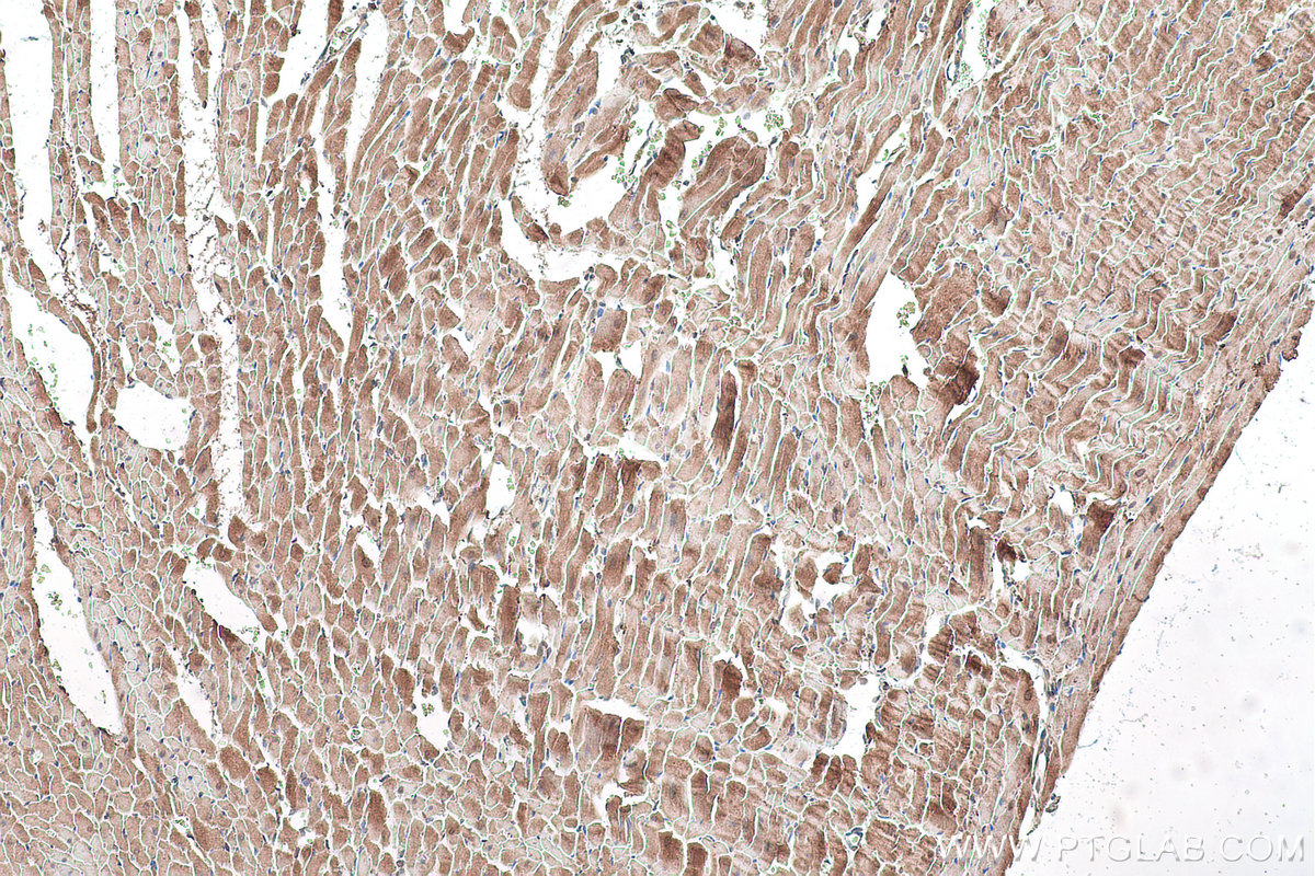 Immunohistochemical analysis of paraffin-embedded rat heart tissue slide using KHC0904 (GYG1 IHC Kit).