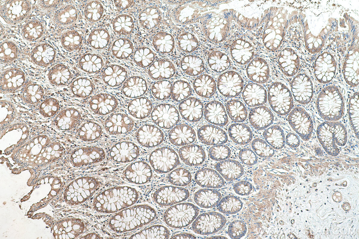 Immunohistochemical analysis of paraffin-embedded human colon tissue slide using KHC0498 (GYS1 IHC Kit).