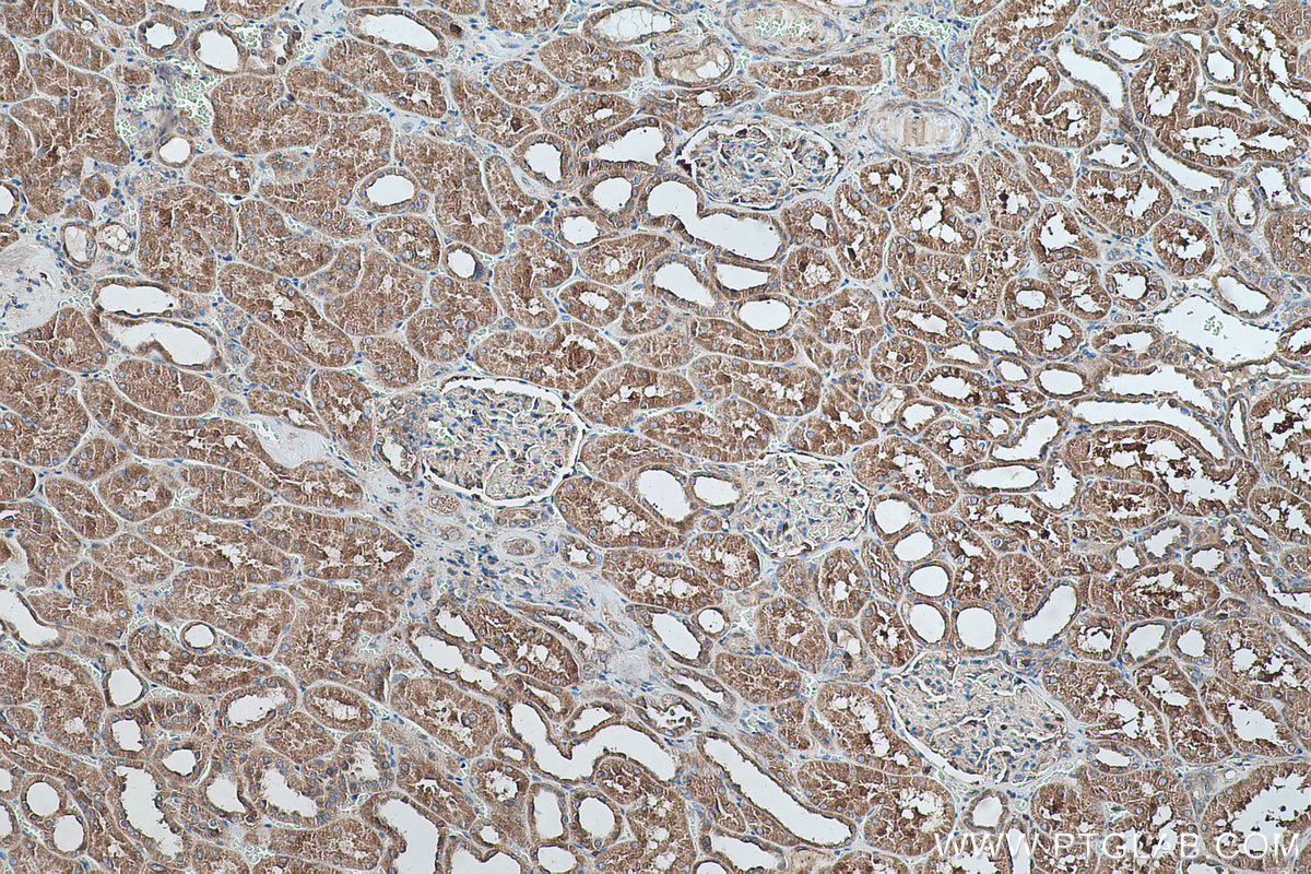 Immunohistochemical analysis of paraffin-embedded human kidney tissue slide using KHC0498 (GYS1 IHC Kit).