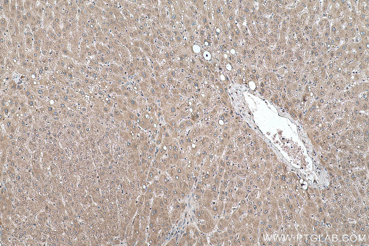 Immunohistochemical analysis of paraffin-embedded human liver tissue slide using KHC0498 (GYS1 IHC Kit).