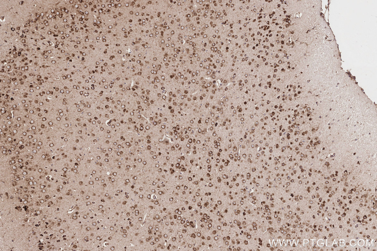 Immunohistochemical analysis of paraffin-embedded mouse brain tissue slide using KHC3214 (GlnRS IHC Kit).