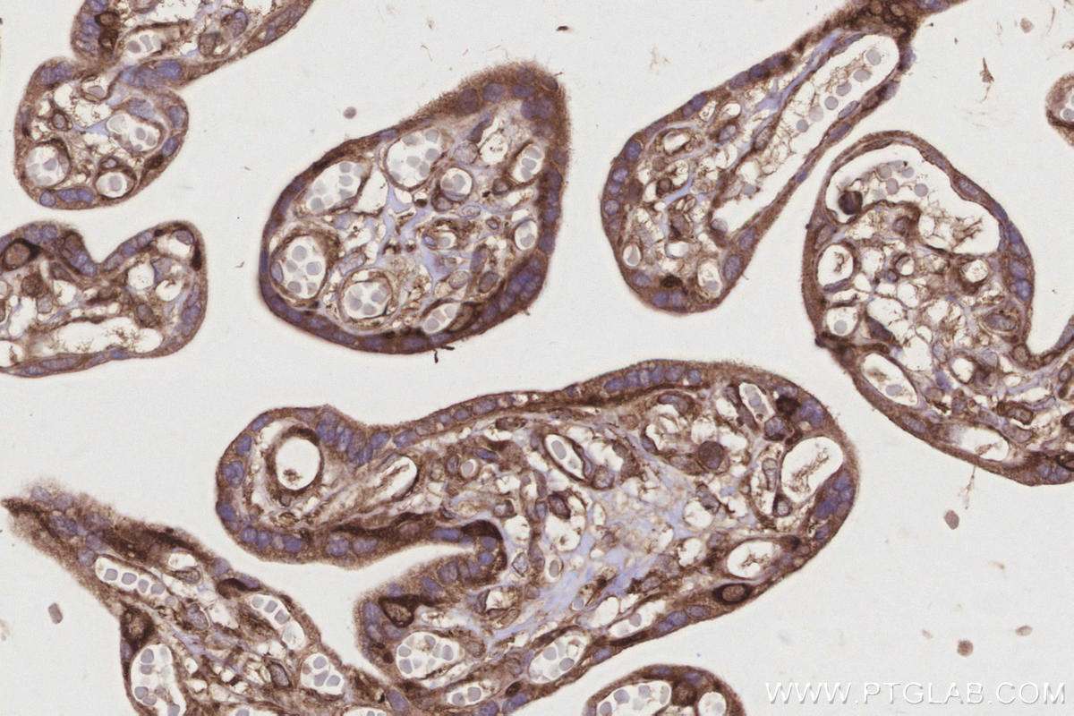 Immunohistochemical analysis of paraffin-embedded human placenta tissue slide using KHC3214 (GlnRS IHC Kit).